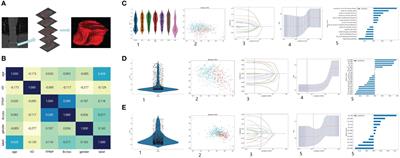 A comprehensive approach for osteoporosis detection through chest CT analysis and bone turnover markers: harnessing radiomics and deep learning techniques